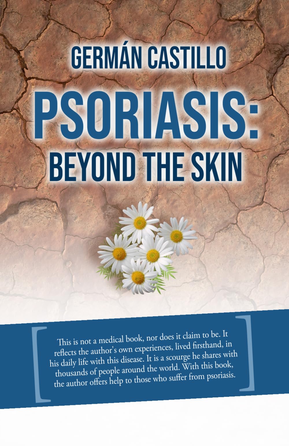 PSORIASIS: Beyond the Skin