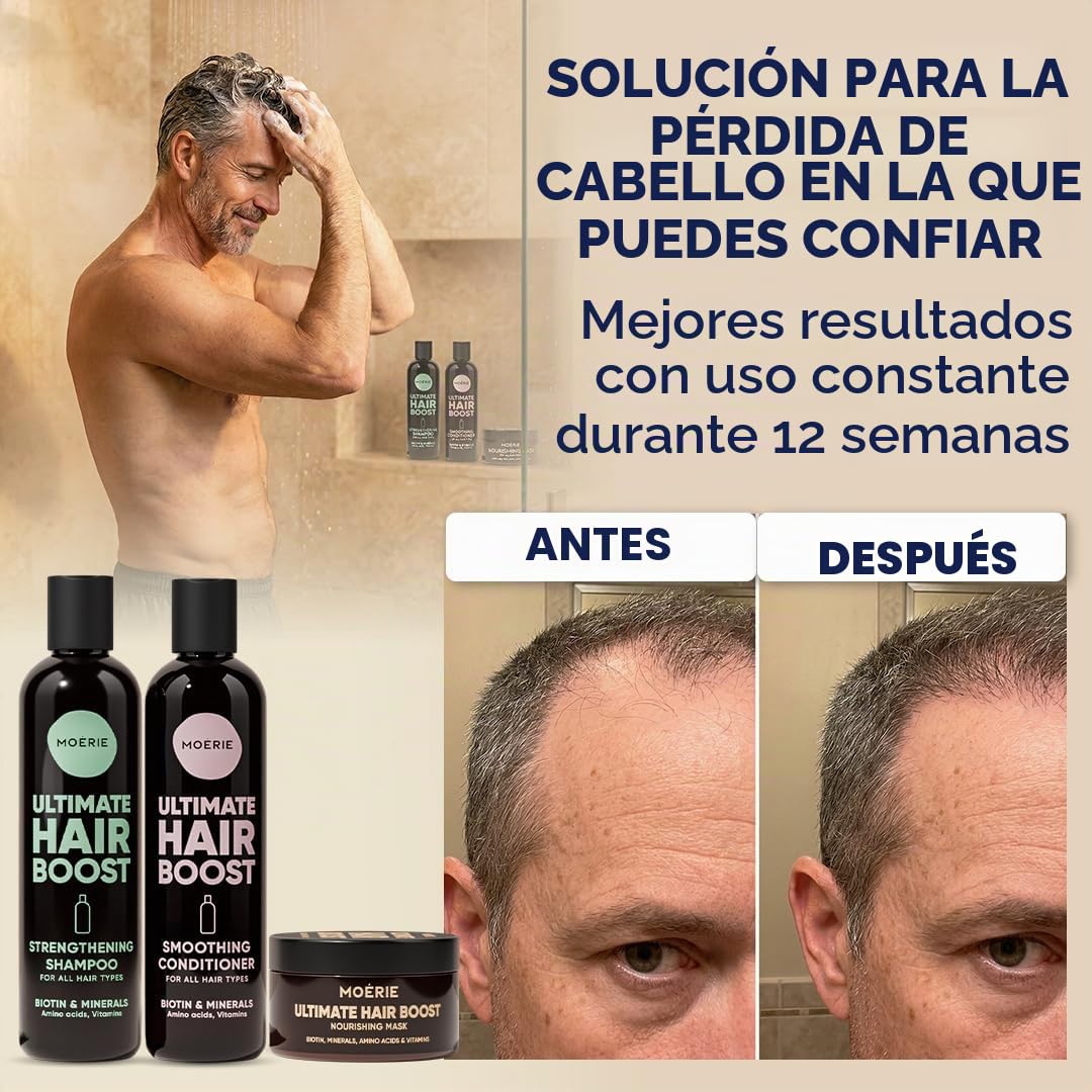 MOERIE Juego de champú de 3 piezas – Champú para el crecimiento del cabello, acondicionador y mascarilla contra la caída del cabello, acelerar el crecimiento del cabello de forma natural, remedio