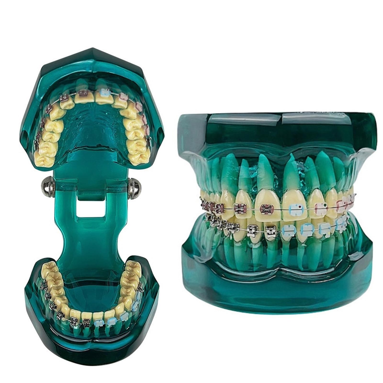 Modello ortodontico per la comunicazione del paziente, trattamento odontoiatrico demo con staffe metalliche autoliganti, ideale per cliniche e scopi educativi
