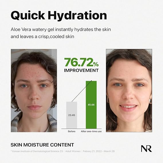 Nature Republic Mild & Moisture Aloe Vera Watery Gel (TUBE) | Quick Hydration & Moisturizing, Fast-Absorbing Non-Sticky Texture, Aftersun Cooling Gel, Korean Skincare, All Skin Types