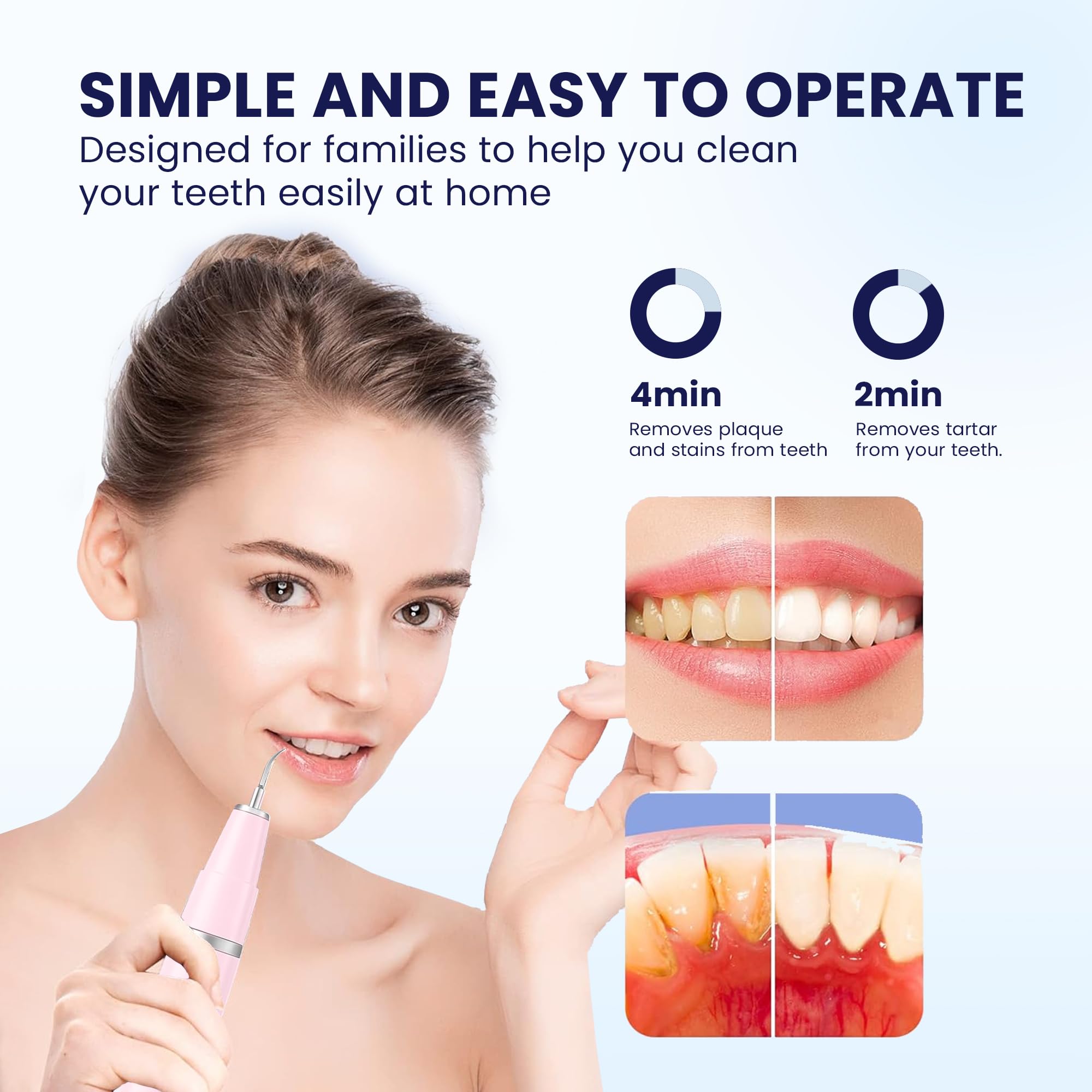 HOKIN Pulizia Denti Tartaro Ablatore Kit - Igiene Dentale Kit per Placca e Tartaro Rimozione Sbiancamento Denti kit con specchietto dentista, per Cura Orale Domestico Rimozione Tartaro, Placa (Rosa)