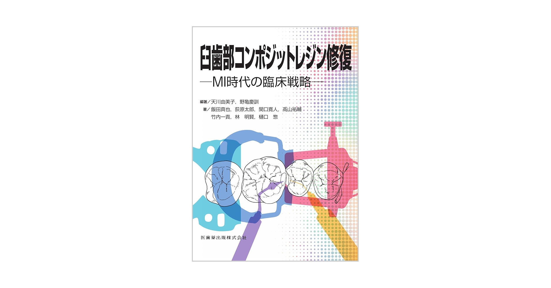 ⚠裁断済　臼歯部コンポジットレジン修復 : MI時代の臨床戦略　☆ ⚠裁断済 臼歯部コンポジットレジン修復 : MI時代の臨床戦略