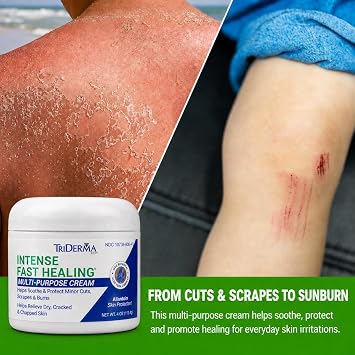 TriDerma Intense Fast Healing Cream for Sores, Cuts, Scrapes, Cracked Hands, Rashes and Hard-to-Heal Skin Irritations, Therapeutic Skin Care Pack of 4