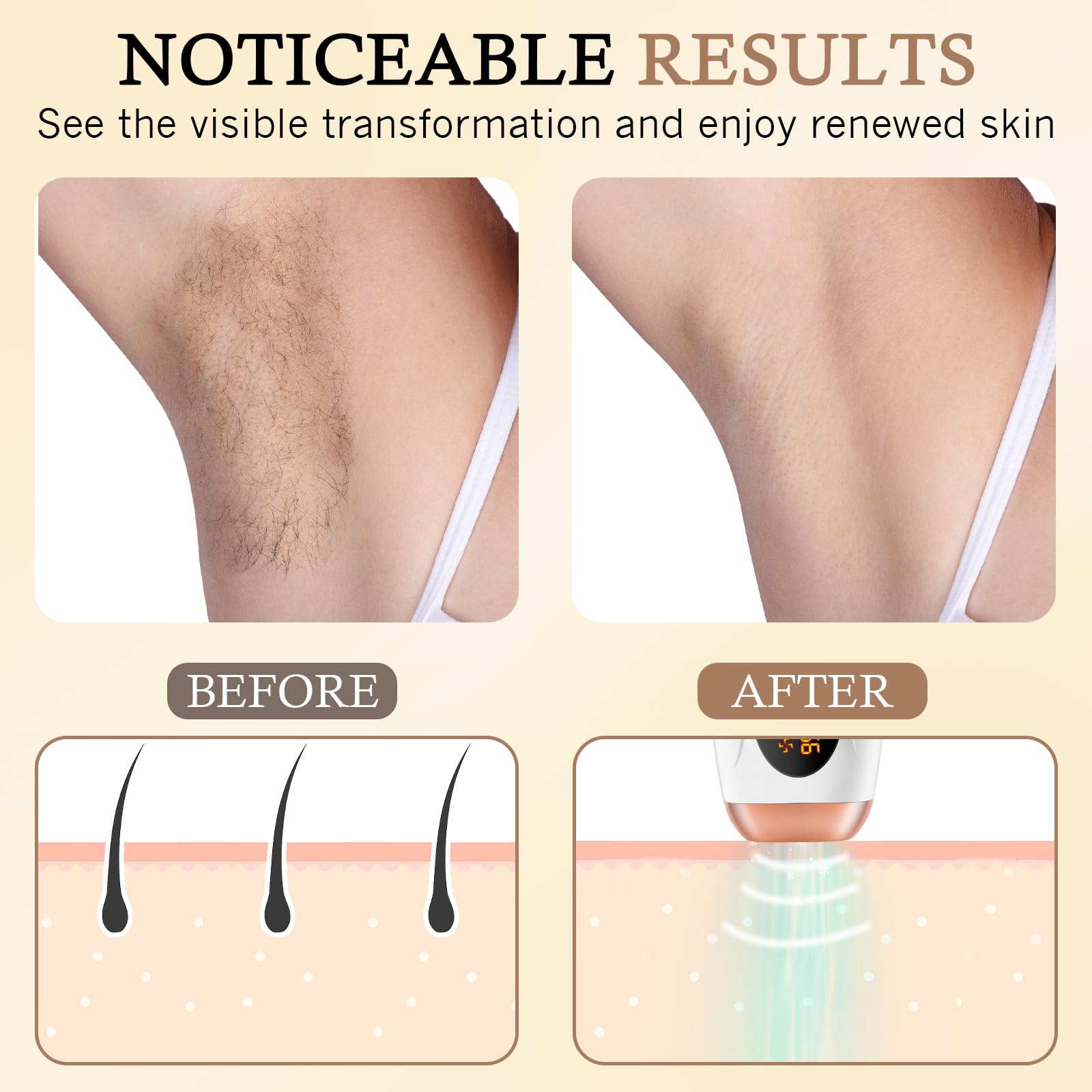 Depiladora Láser IPL con Función de Enfriamiento, 999.999 Flashes, 5 Niveles de Energía y 2 Modos, Depilación Luz Pulsada Indolora para Mujeres y Hombres, Cara, Cuerpo, Axilas, Bikini