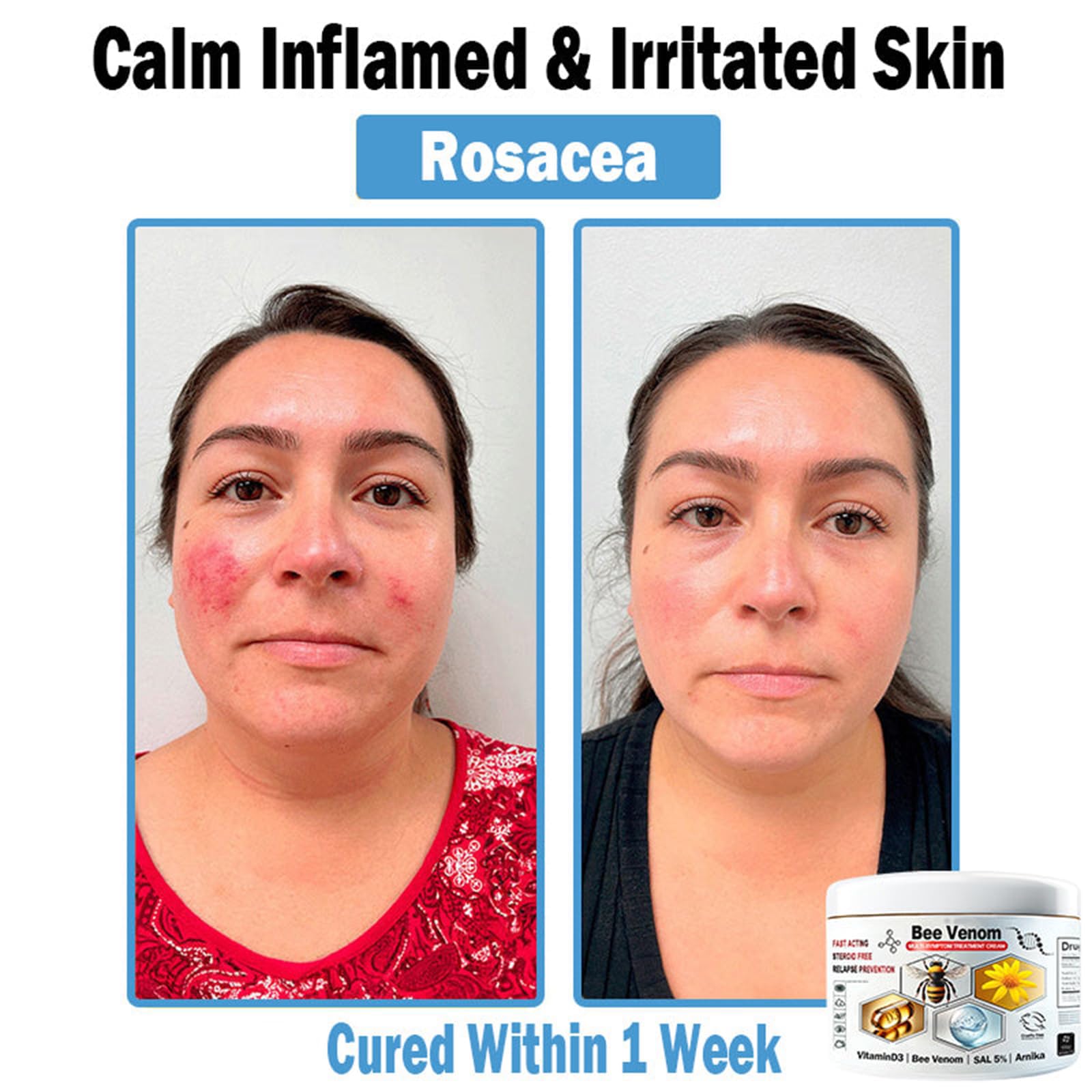 DEJIN 2Pcs Bee Venom Cream for Face & Body - Skin Restoration & Wrinkle Firming Cream, Bee Venom Cream for Saggy Skin - Image 2