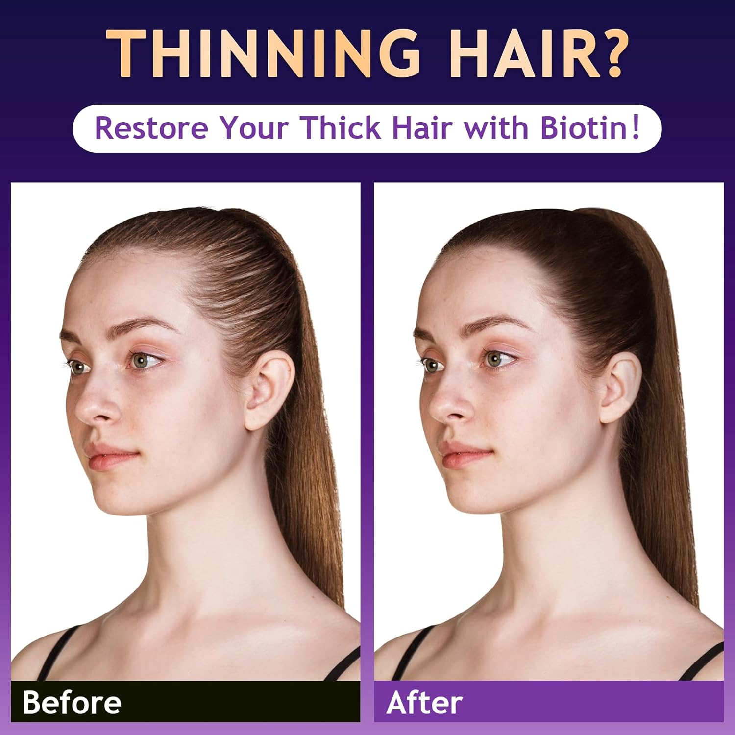 Biotin Hair Growth & Thickening Shampoo with Root Activator, Hair Loss Shampoo for Men And Women, Strengthen Roots, Control Oil & Thicken Thin Hair, Sulfate-Free, for All Hair Types, 10.1 Fl Oz-Fresh - Image 2