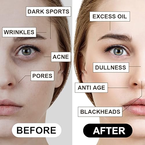 Miniatura 5 de NUSPA Paquete de 4 limpiadores suaves antienvejecimiento, crema facial reparadora de colágeno, antiarrugas, antienvejecimiento, eliminación de ojos