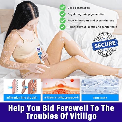 Miniatura 3 de PLAZALA Crema de vitiligo, tratamiento natural eficaz para el vitíligo, crema para el cuidado del vitíligo para reducir las manchas blancas y