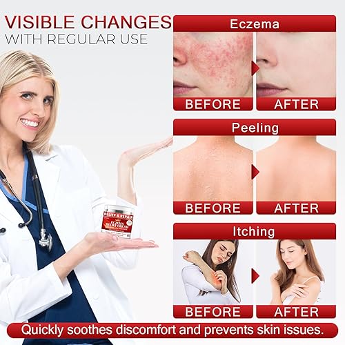 Miniatura 6 de Crema de eczema para niños y adultos - Crema para aliviar el eccema para enrojecimiento, picazón, piel seca, hidratante diario para pieles