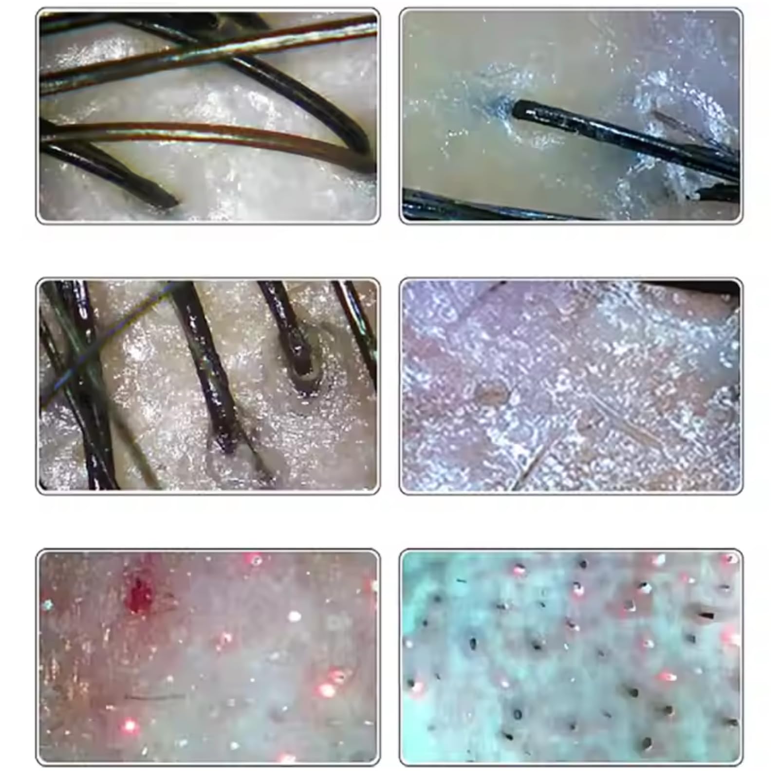 Analyseur de cheveux de diagnostic de peau, grand détecteur avancé de cuir chevelu de 28 cm, multifonction avec 50 x 200 têtes doubles, détection de la santé de la peau et du cuir chevelu pour une