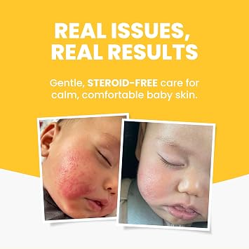 Grahams Natural Baby Eczema Cream Moisturizer for Newborn-12 Years | Rash, Redness, Dry Skin & Itch Relief | Colloidal Oatmeal & Shea Butter | Steroid-Free, Fragrance-Free for Sensitive Skin (75g)