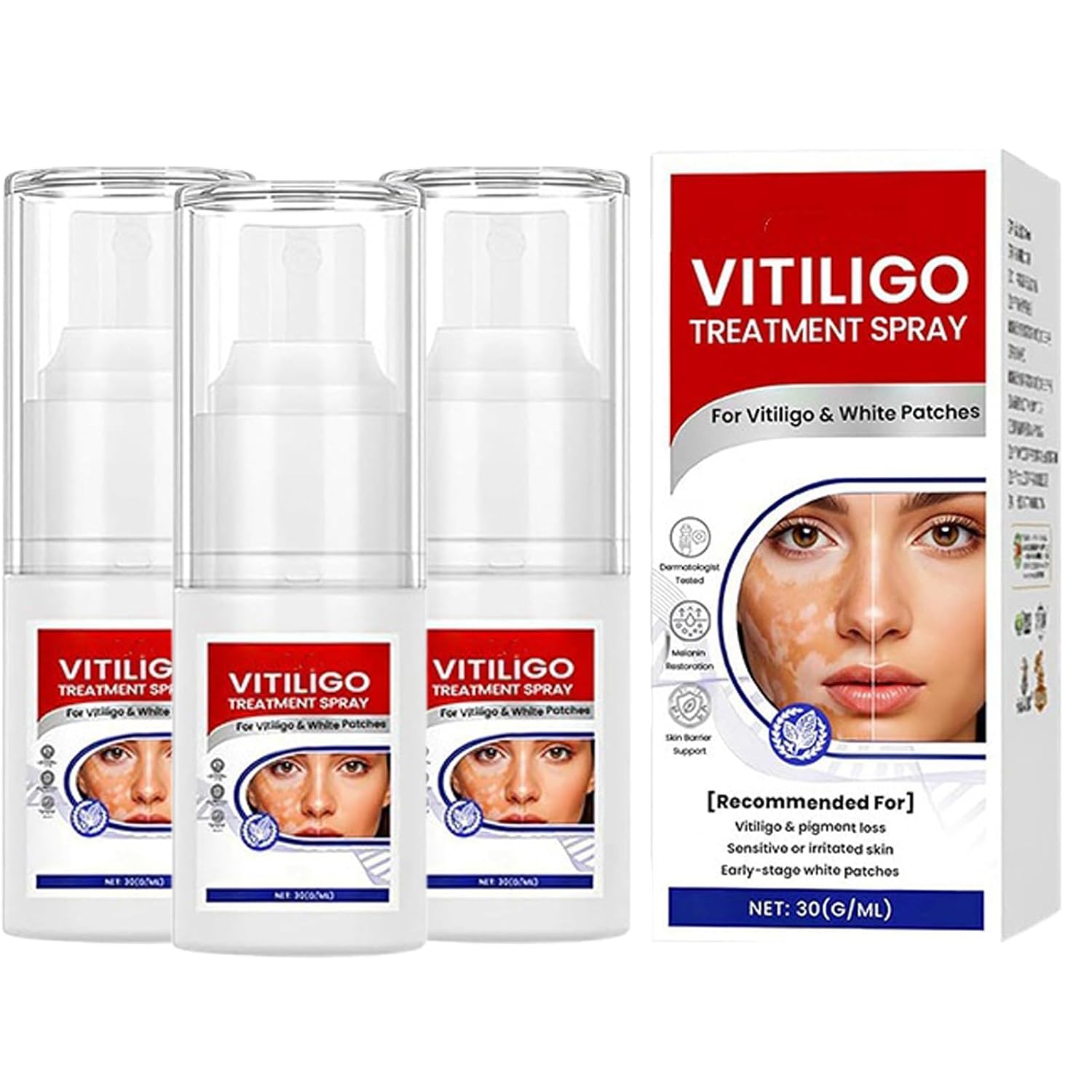 amazon-vitiligo-spray-professional-white-spot-remover-for-skin