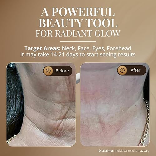 Miniatura 32 de GLO24K - Dispositivo de belleza facial y cuello con luz roja, herramienta de masajeador facial 3 en 1 con LED y vibración para revitalización