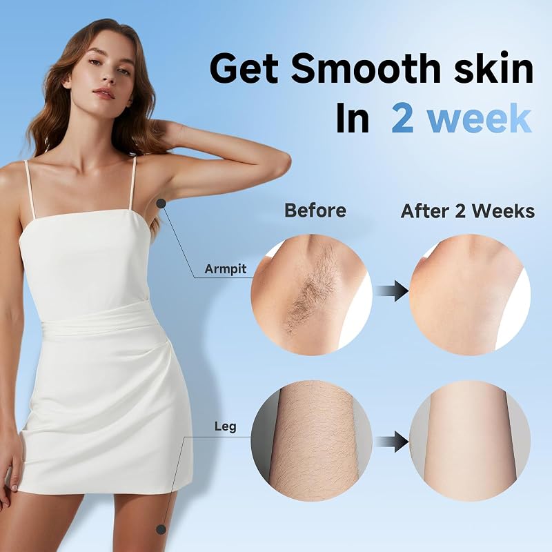 YOEYOU Painless IPL Laser Hair Removal – Customizable settings for sensitive areas