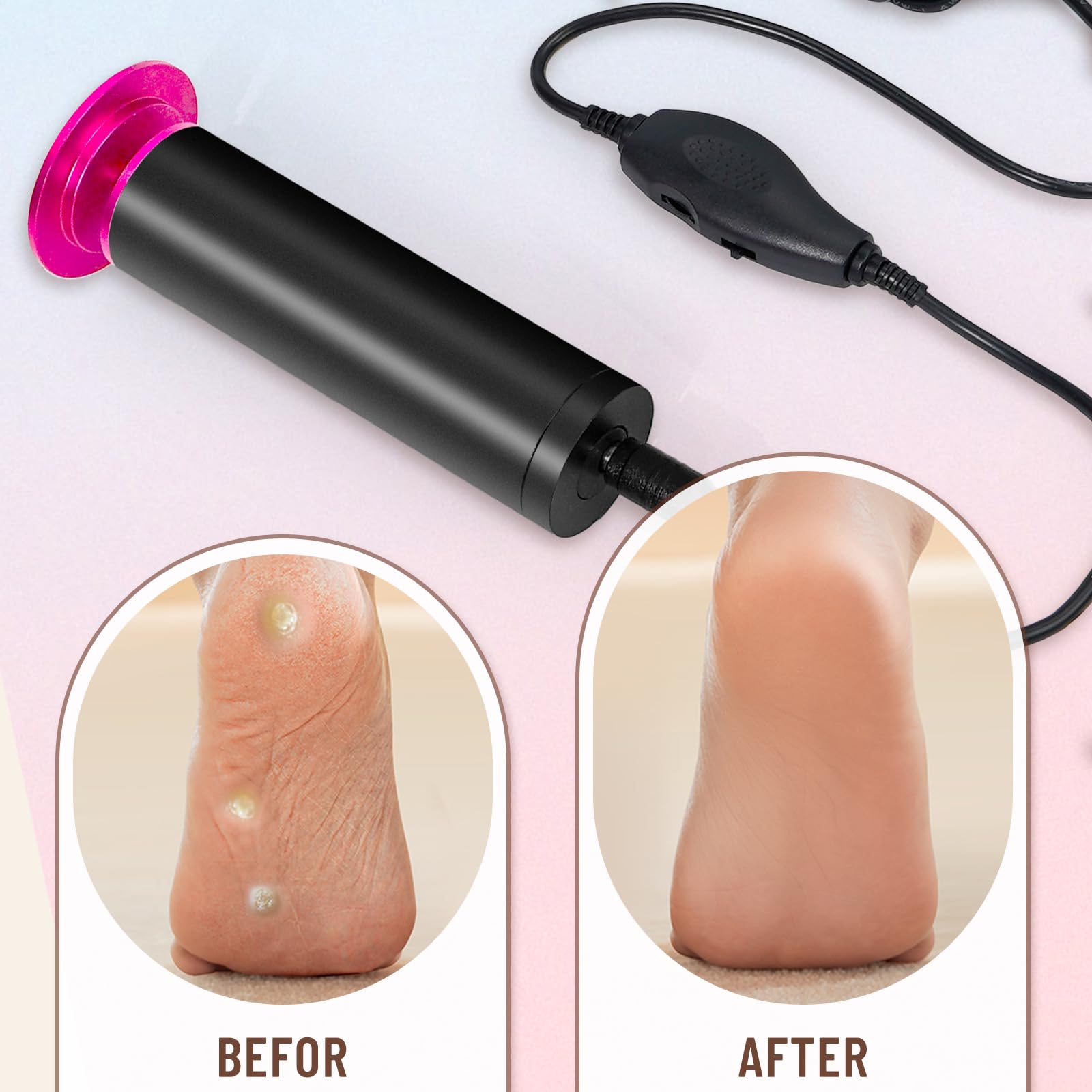 Dermawave - Lima eléctrica para pies, removedor de callos para pies, lijadora profesional para piel muerta y talón agrietado, herramienta de pedicura con 60 discos de papel de lija para hombres y