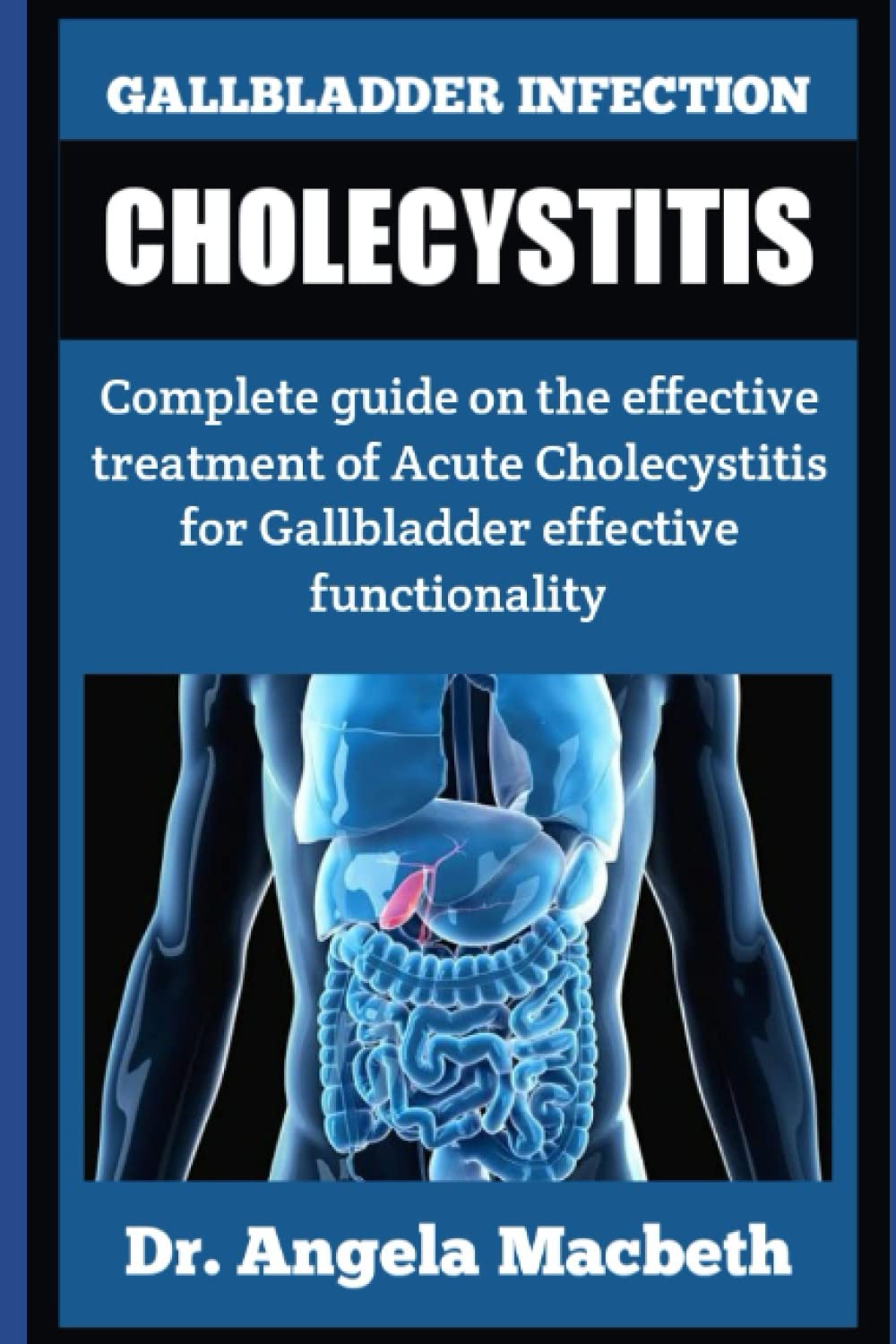 Buy GALLBLADDER INFECTION CHOLECYSTITIS Complete guide on the