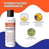 Vista 4 de Mite-B-Gone Loción de tratamiento de 4 onzas Loción de azufre natural Max-Strength para ácaros humanos de acción rápida, mordedura de insectos