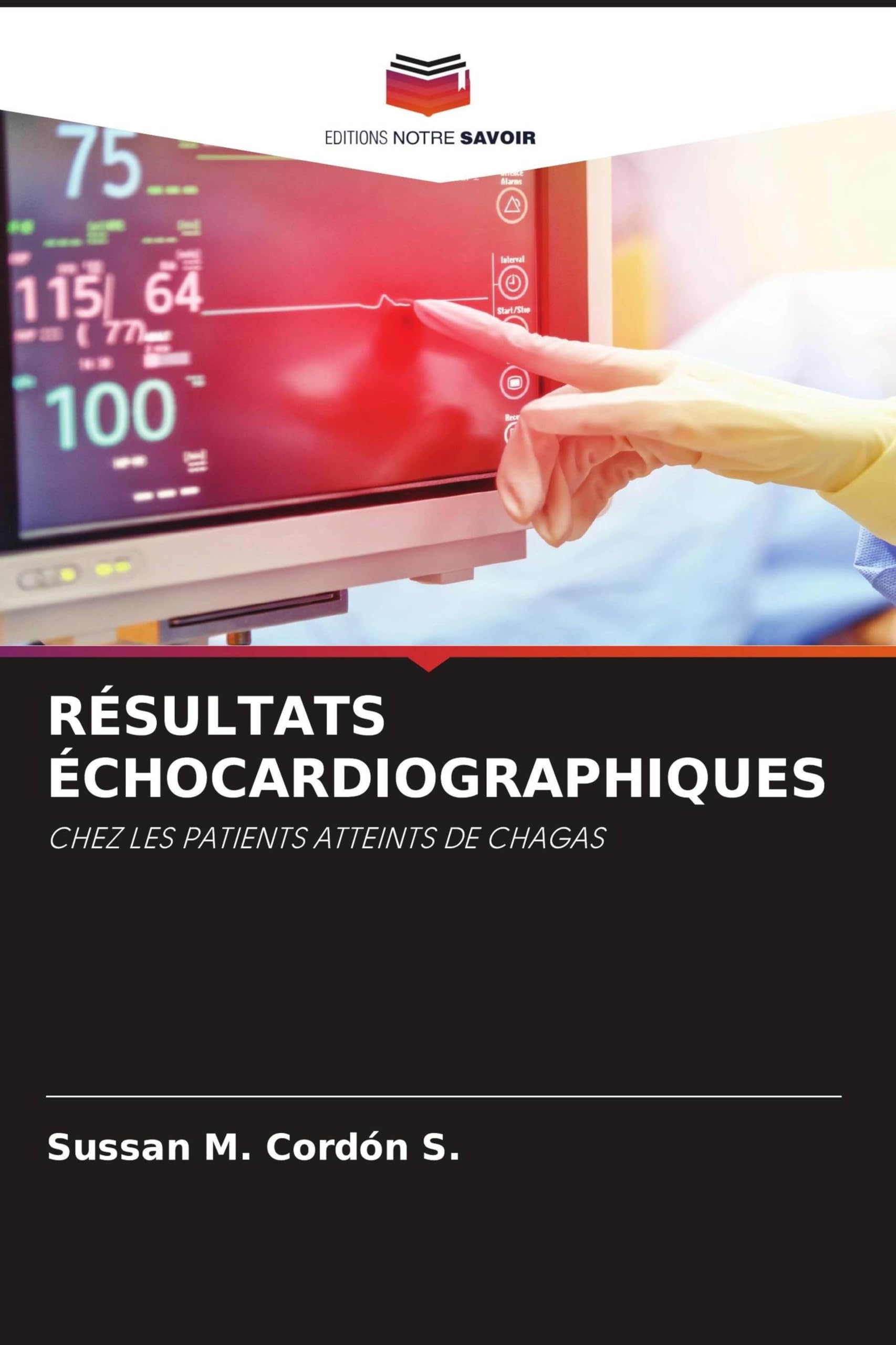 Résultats Échocardiographiques: CHEZ LES PATIENTS ATTEINTS DE CHAGAS