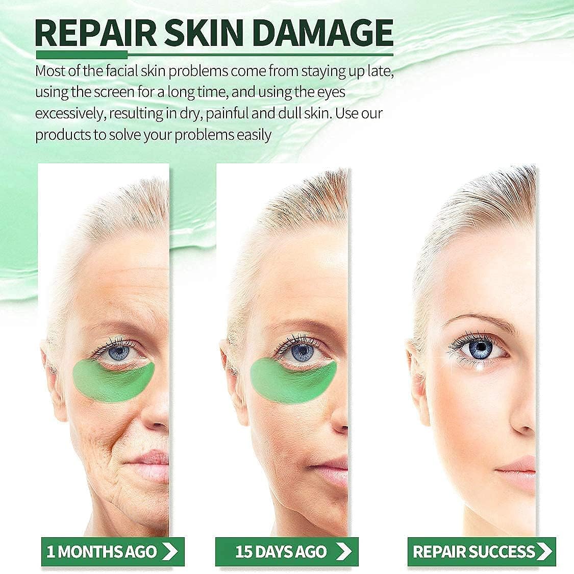 WICHARSH Seaweed Under Eye Patches 60 PCS Collagen Gel Masks for Puffy Eyes, Dark Circles & Wrinkles Anti-Aging Hydrating Eye Pads with Hyaluronic Acid for Skin Tightening & Moisturizing 1