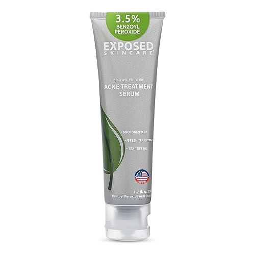 Exposed Skin Care, Suero de tratamiento para el acné con peróxido de benzoilo al 3.5% - Tratamiento ligero para manchas de acné - Elimina