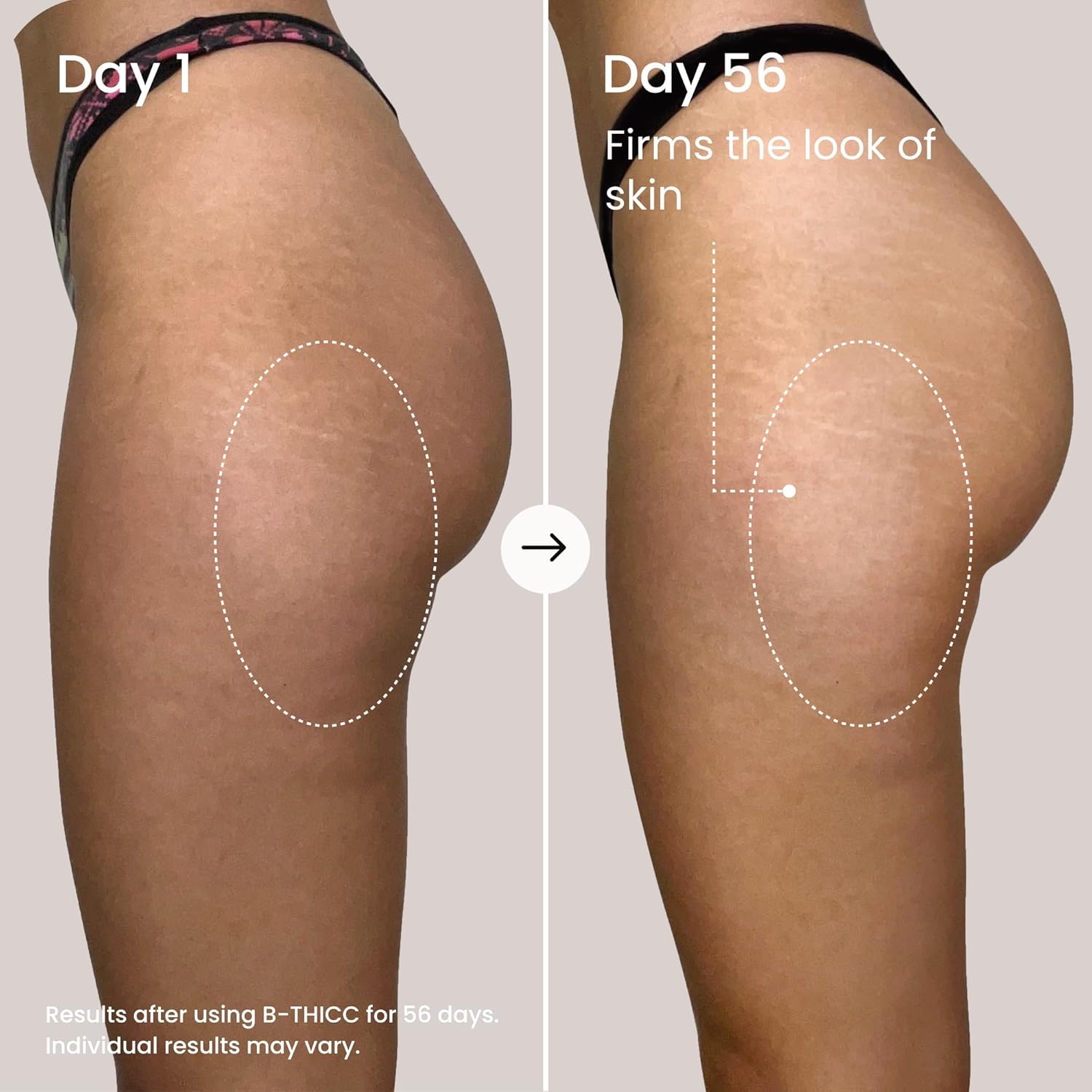 MAËLYS B-THICC Booty Enhancing Mask - Plumping & Firming Body Cream for Booty Area - Skin Tightening With Hydrating Hyaluronic Acid & Grape Seed Oil (3.38 Fl Oz) - Image 3