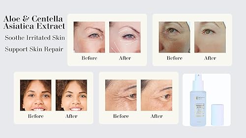 Miniatura 4 de Retinol Night Serum Complex - Suero facial antienvejecimiento que reafirma el ácido hialurónico para rostro y cuello, niacinamida, colágeno, C y E,