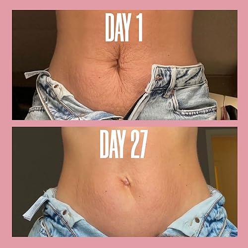 Miniatura 6 de MAELYS THE THIGH & BELLY STRETCH MARK DUO