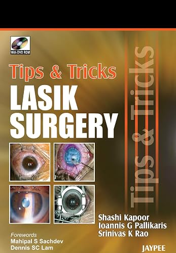 JAYPEE Tips and Tricks Lasik Surgery (with DVD-ROM)