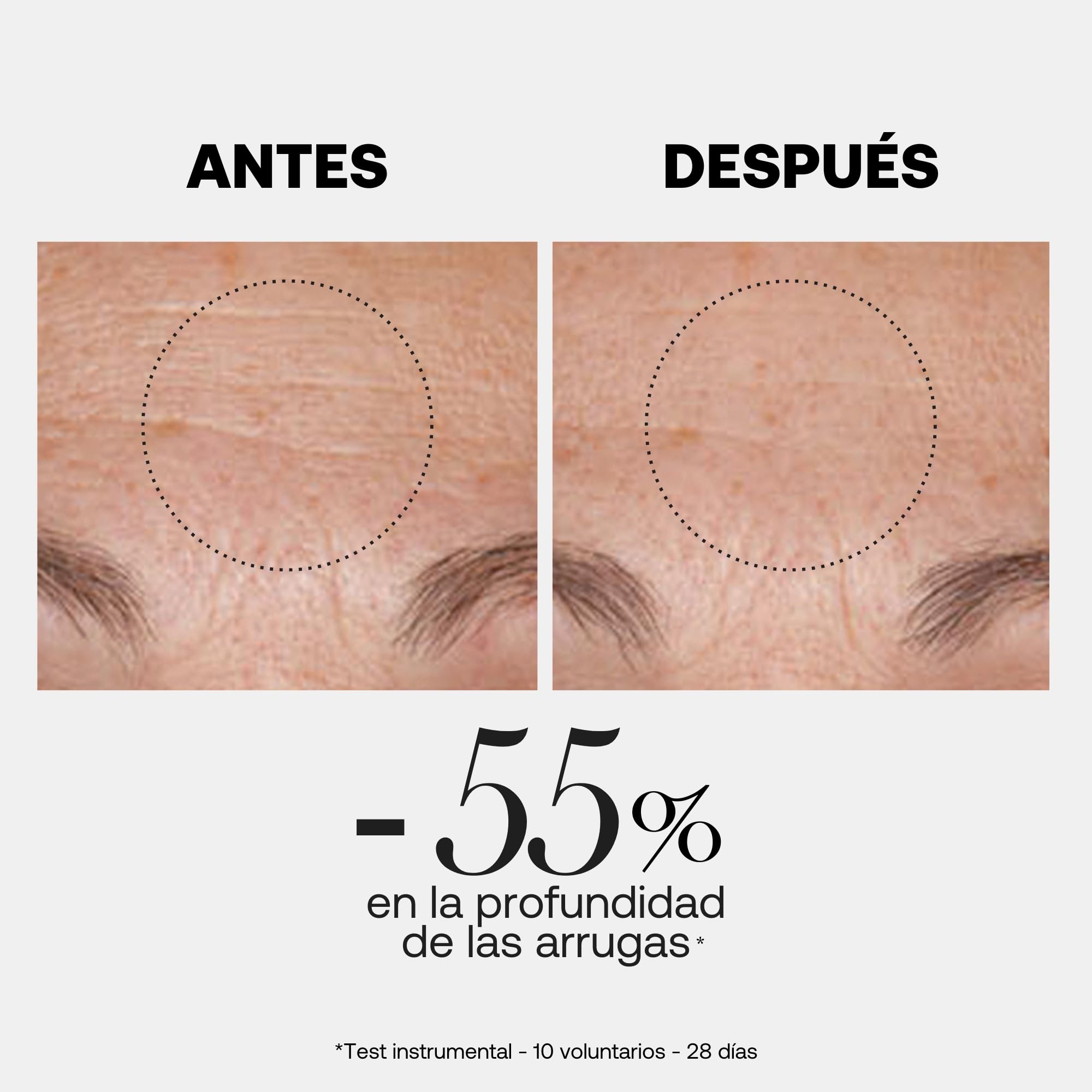 Rexaline LINE KILLER RICH CREMA – Bálsamo Antiarrugas Reafirmante – Ácido Hialurónico RX2, Lipopeptidos DWK y Centella Asiática – Pieles Maduras Muy Secas – 50 ml
