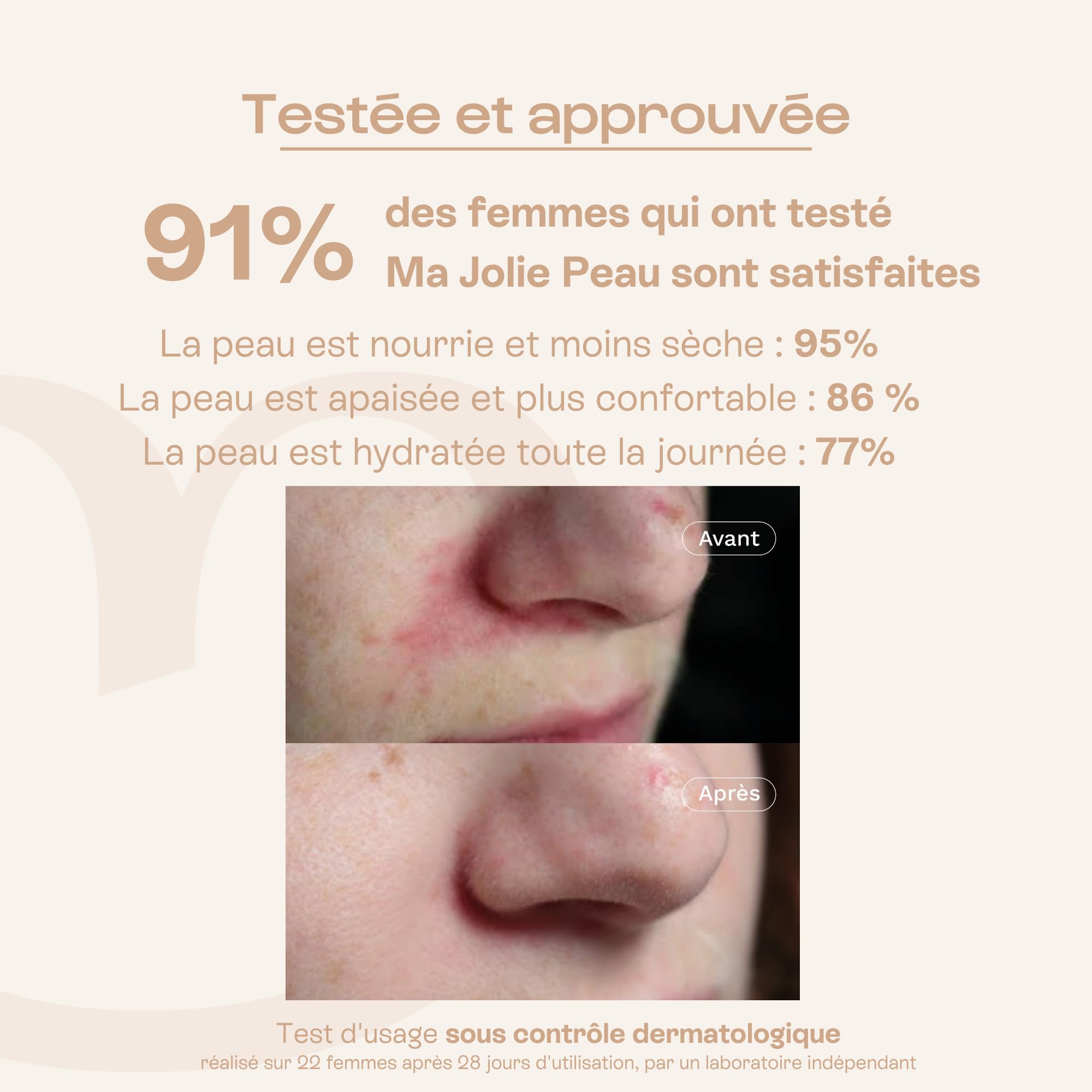 OMUM - Ma Jolie Peau - Crème visage rééquilibrante & hydratante aux prébiotiques naturels - Peaux mixtes et peaux fragilisées - Anti rougeur et anti bouton - Compatible grossesse - Vegan - 40 ml