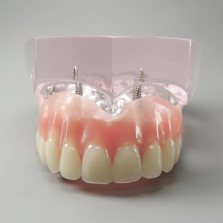 denture 様　NEIGHBORHOOD Dentures | Effingham Smiles Family Dentistry
