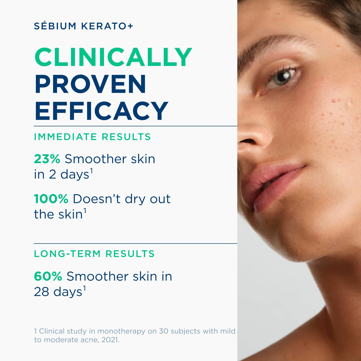 BIODERMA Sebium Kerato+ Gel-Crème Anti-Unreinheiten-Pflege bei unreiner bis zu Akne neigender Haut, 30 ml Kremowa