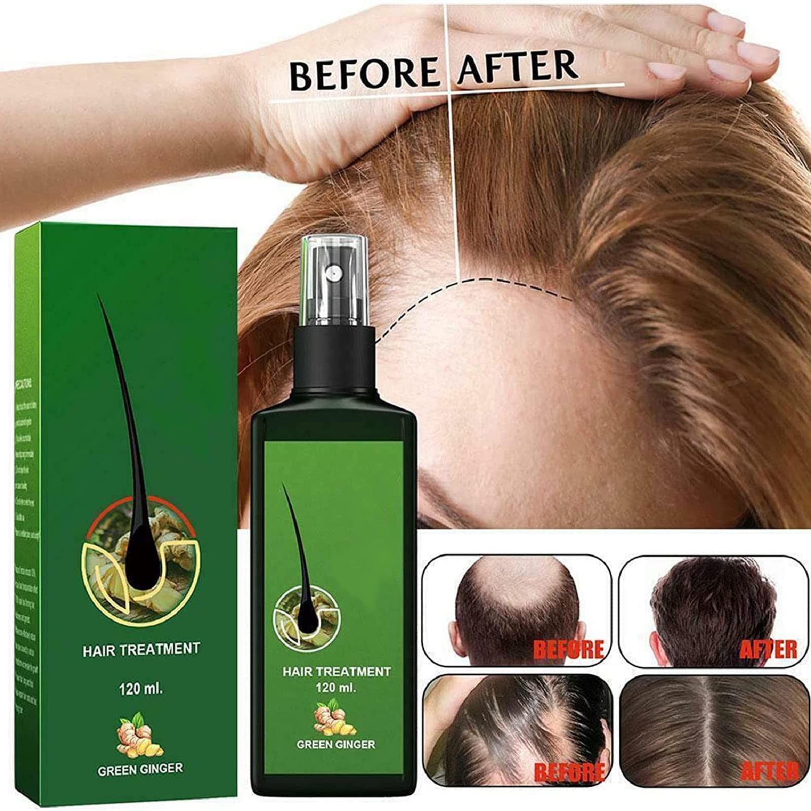 Loción capilar para el crecimiento del cabello, 3 unidades para hombres y mujeres, mejora N3, Growthplus Nourishing Ginger Spray, Hair Lotion Hair Root Hair Beard with Roller, Hair Lotion Herbs