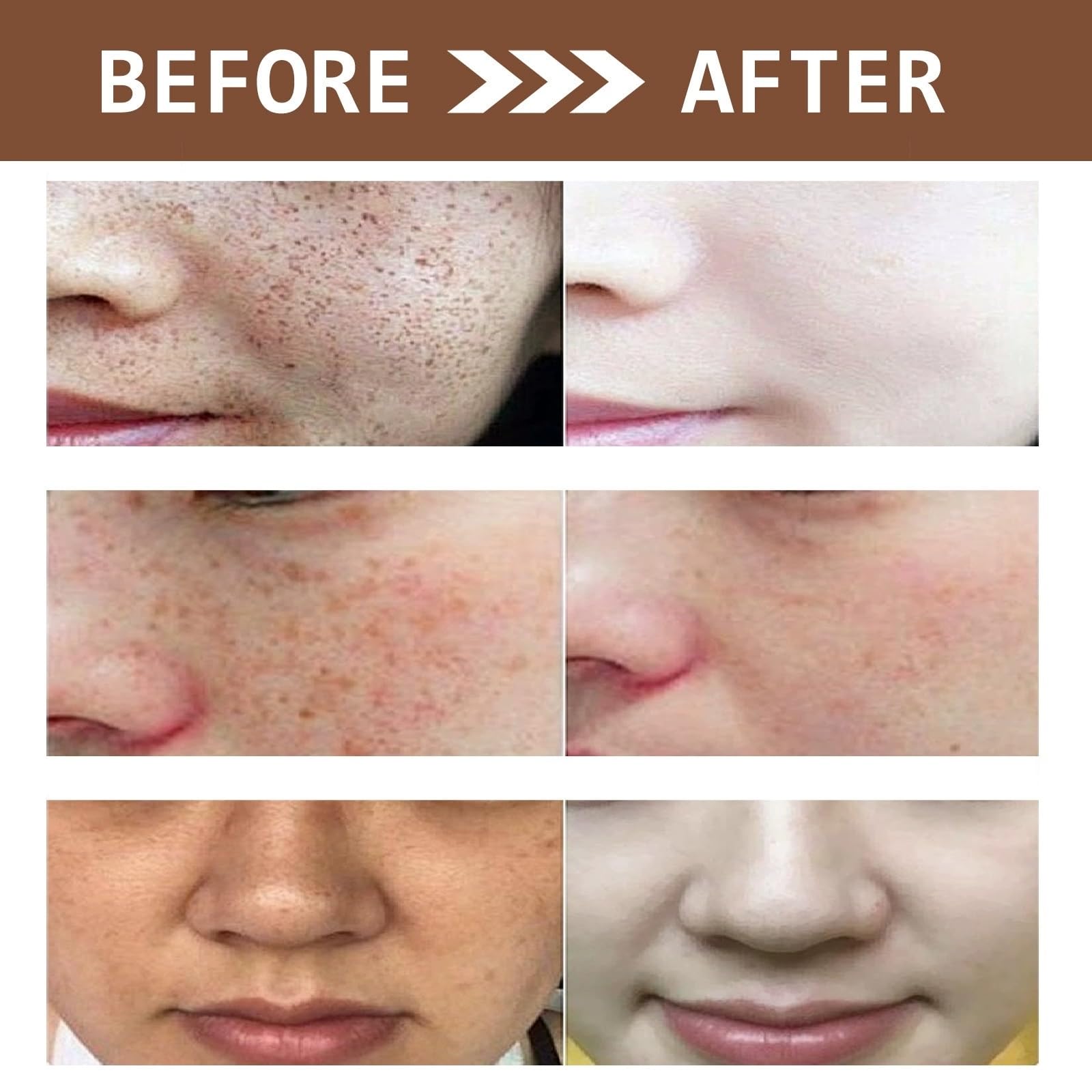 glutathione anti aging before and after Skin Brightening Cream, Brightening Anti-Aging Face Cream, Whitening Cream for Dark Spot Removal, Skin Brightening Moisturizing Toning chemical free soap in india Improved pH stability, heat Color:Mint Silk