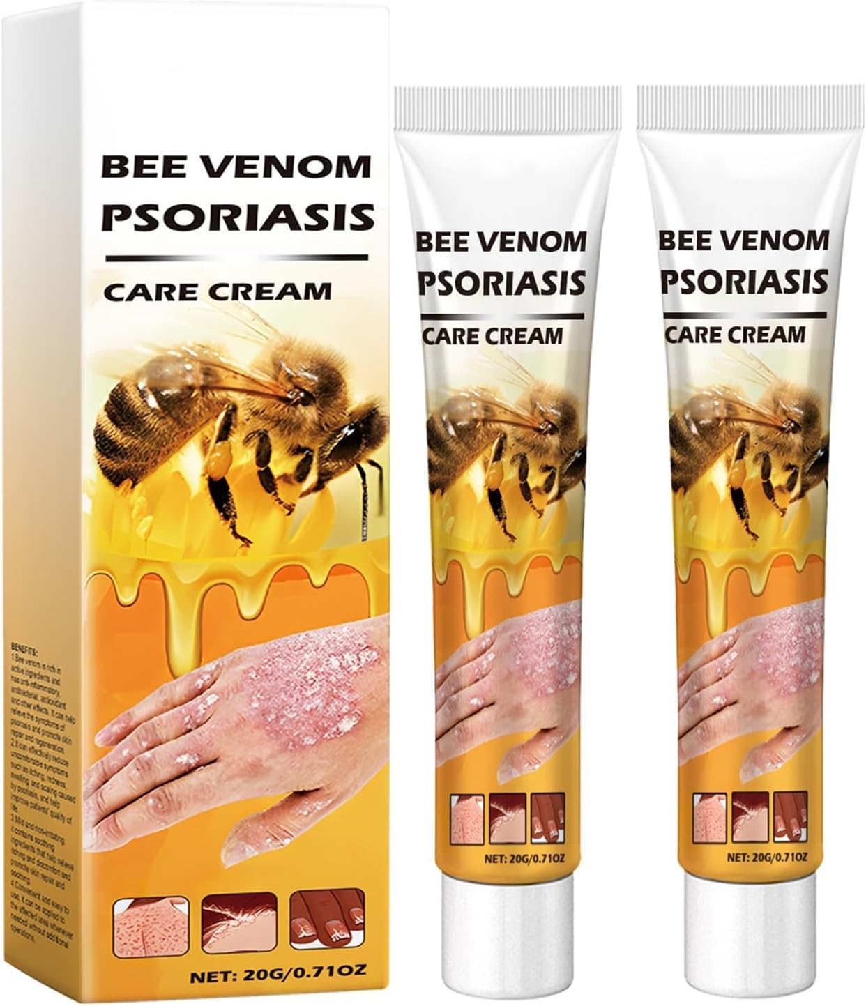 Bee Venom Psoriasis Cream, Bee Venom Cream for Psoriasis, Soothing Pso-riasis Cre-am, Body Cre-am for Redness & Itching, Hand & Leg & Arm Body Care(2PCS)