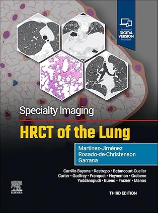 Specialty Imaging: HRCT of the Lung -3E