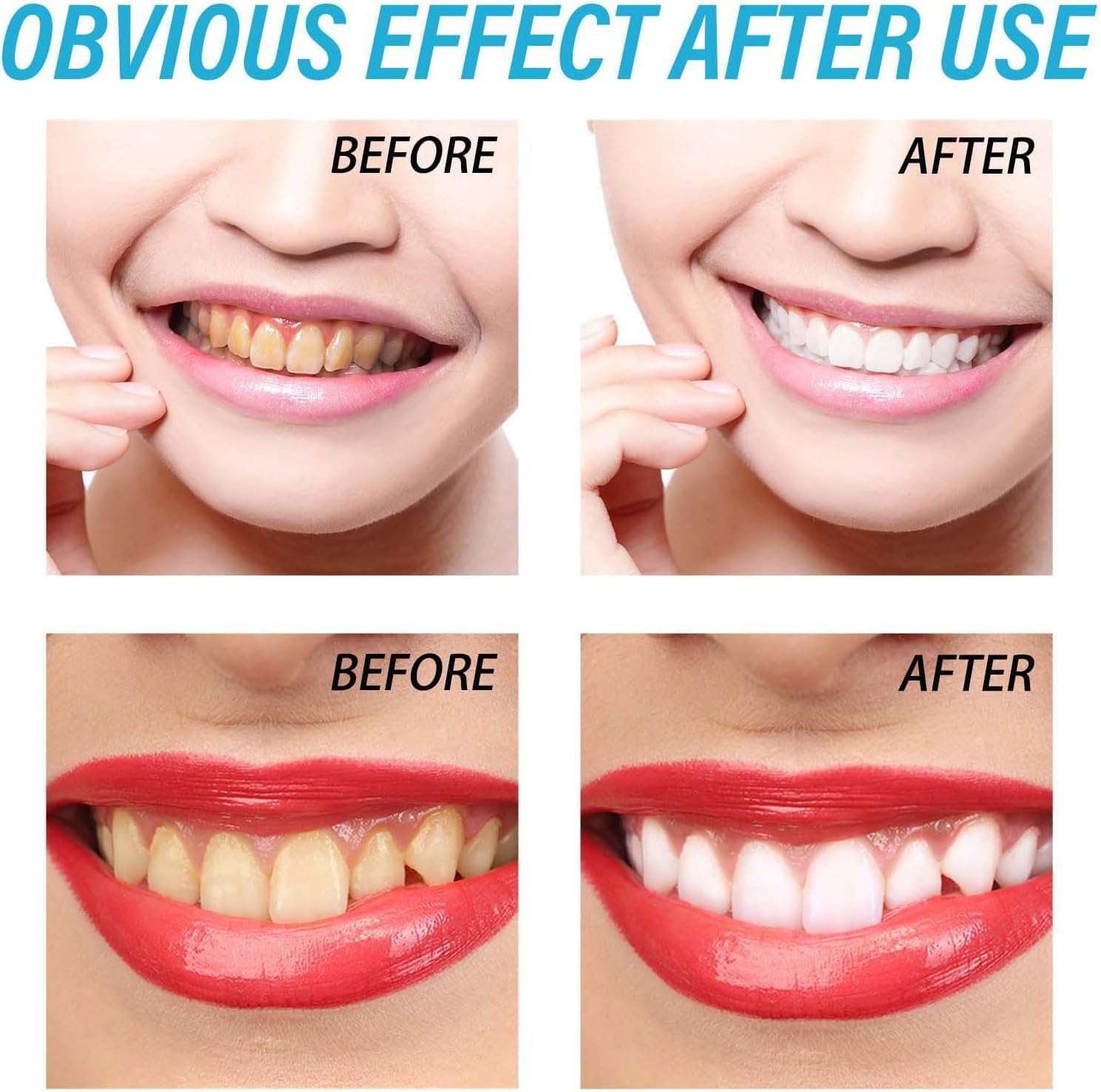 Gocce Rigenerazione Gengivale,Riparazione Ricrescita Delles Gengive,Protezione Cura Dei Denti,Per Tutti,30ML
