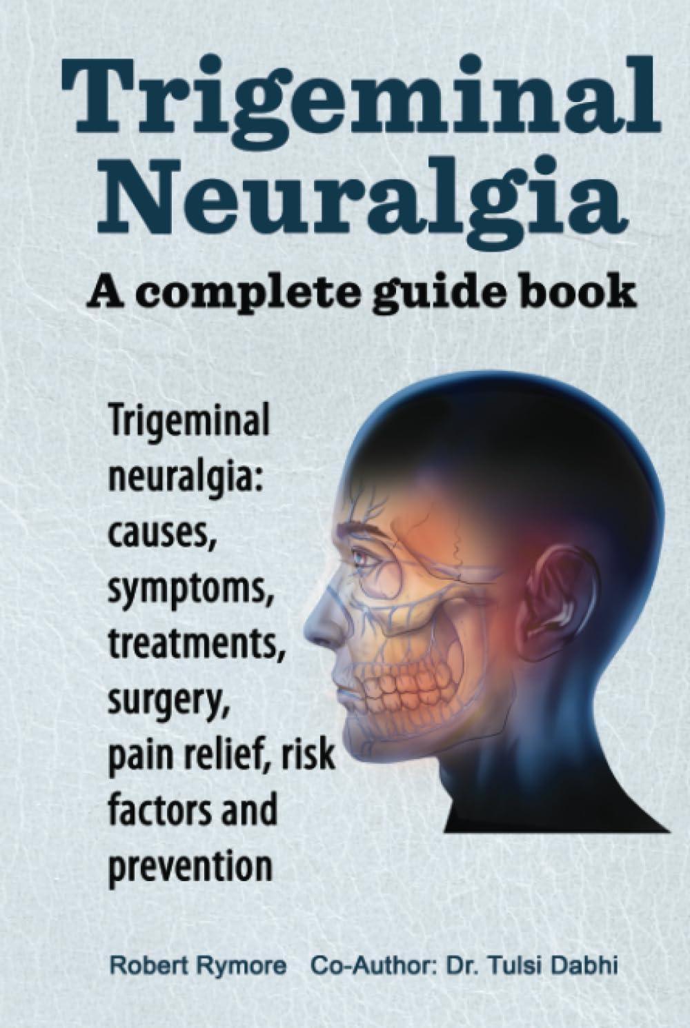 Trigeminal Neuralgia. A complete guide book. Trigeminal neuralgia: causes, symptoms, treatments, surgery, pain relief, risk factors and prevention.