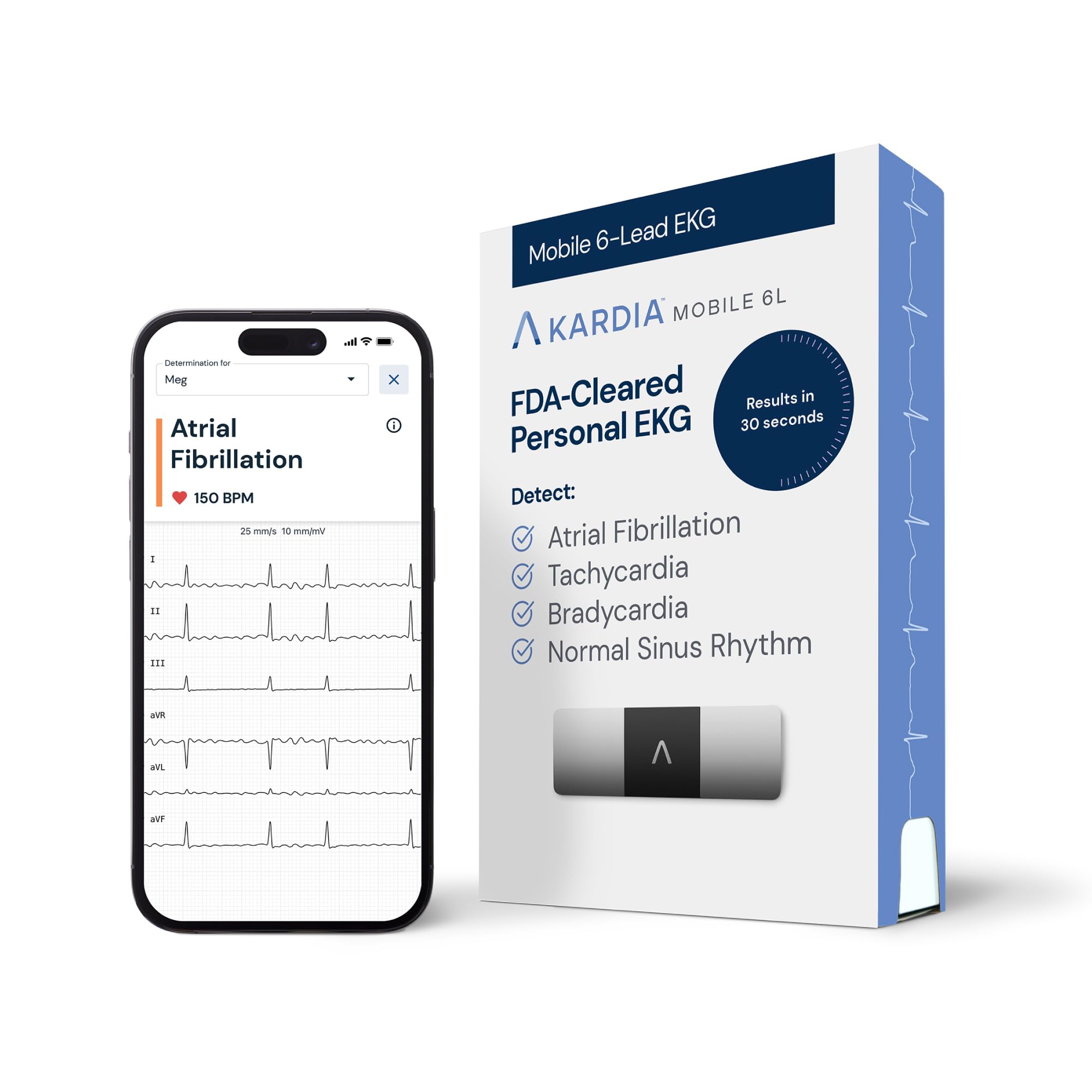 Kardiamobile Electrocardiografo Portatil de 6 derivaciones – Detecta fibrilación Auricular – Resultados instantáneos en 30 Segundos – Funciona con la mayoría de los Smartphones