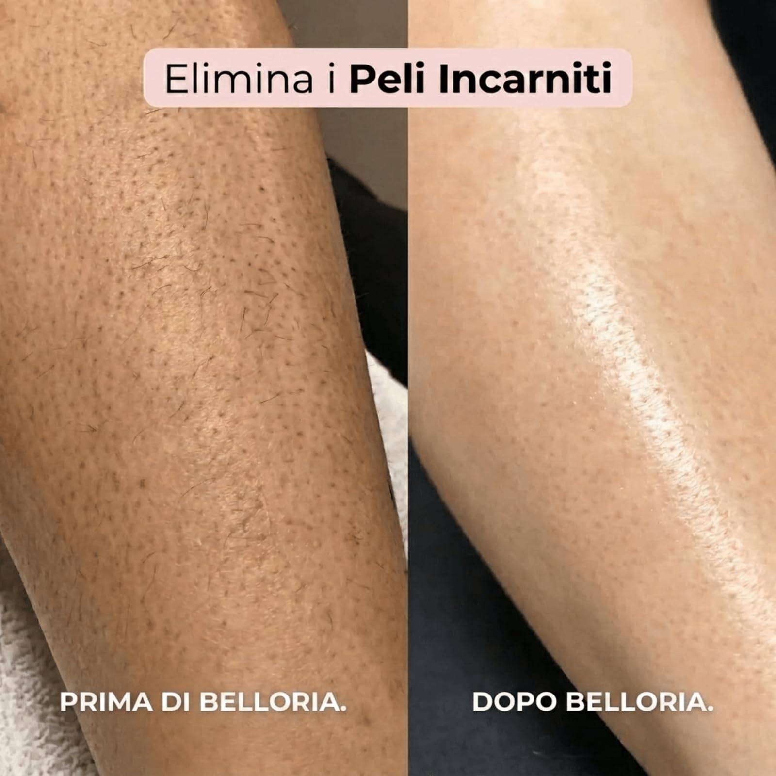 Belloria Rasoio 2 in 1 per bikini e corpo | Rifinitore Bikini e Rasoio Intimo Impermeabile IPX7,Rasatore Delicato Uso Secco e Bagnato per Gambe Ascelle e Viso