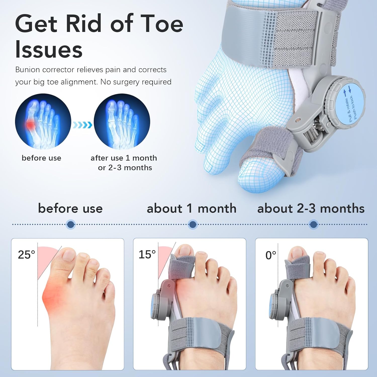 Bunion Corrector for Women Men: Big Toe Straightener Bunion Fix with Adjustable Knob-Orthopedic Bunions Splint Brace Toe Alignment Correction for Hallux Valgus Pain Relief Day/Night (Grey) - Image 2
