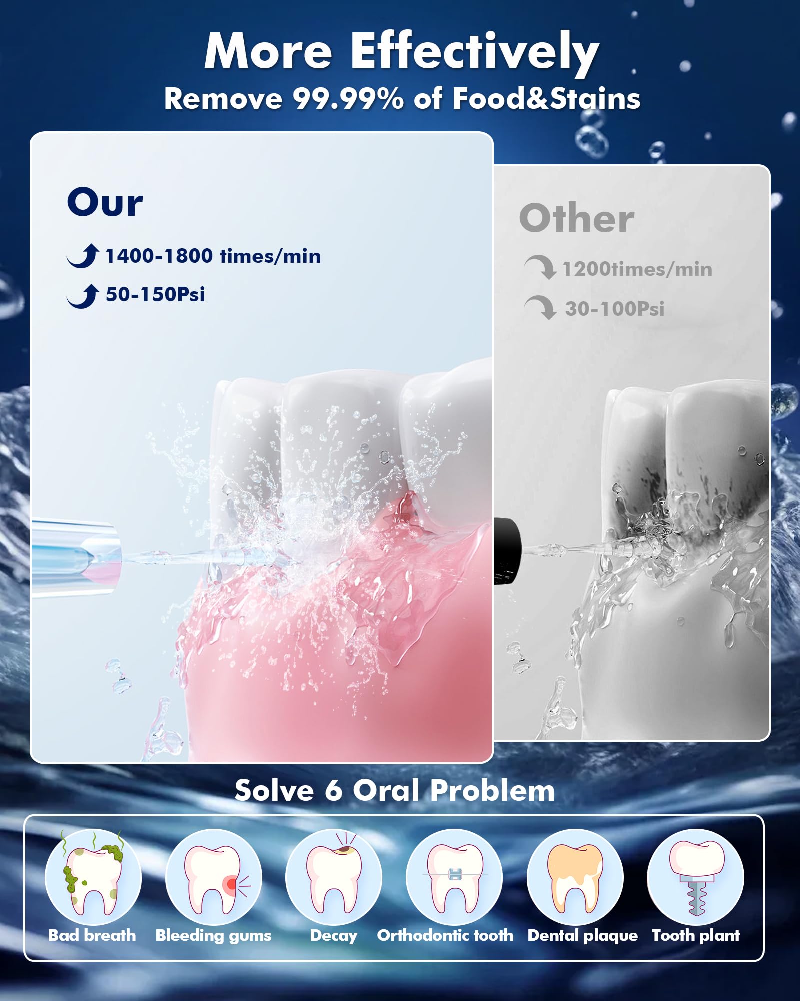Water Flossers for Teeth, 5 Modes, 6 Flossing Tips - Image 3