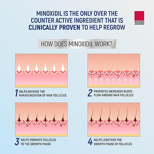 Miniatura 10 de Taro Minoxidil - Espuma en aerosol tópica, 5%, regeneración del cabello 4 meses, tratamiento para hombres, 2.11 onzas (paquete de 4)