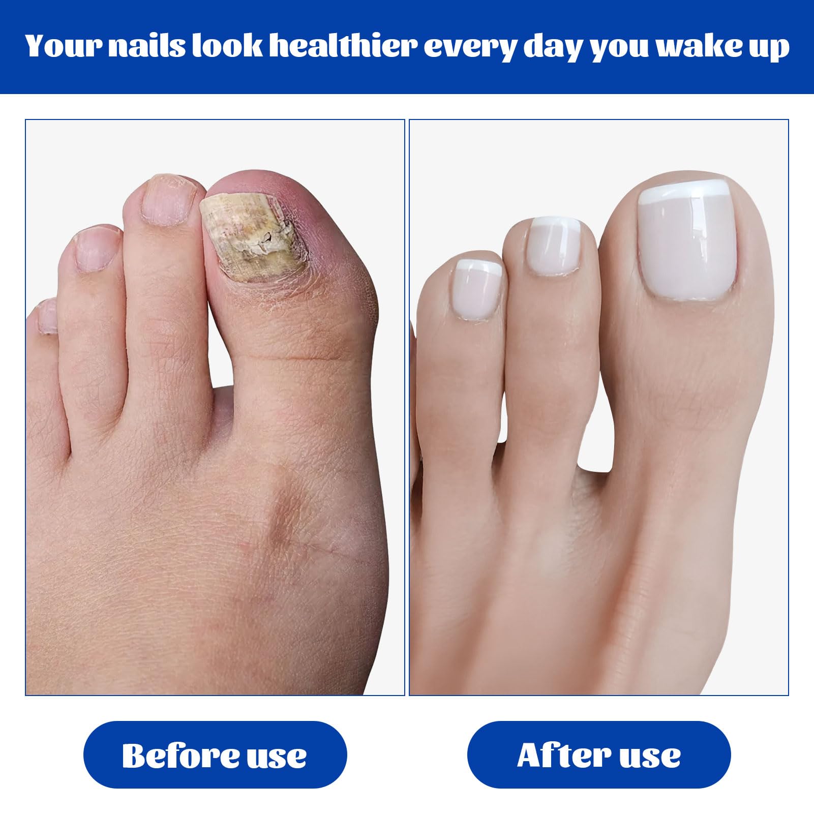 Fungal Nail Treatment for Toenails Extra Strong,1 BOX 60PCS Nail Repair Patches,Nail Fungus Treatment for Toenail,Toe Nail Fungal Treatment for Toenails Extra Strong,Nail Fungal Treatment Patches - Image 4