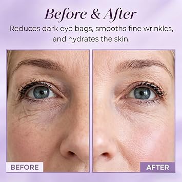 Calcium Multi Balm Stick,Daily Skin Care Collagen Balm Stick, Calcium Volume Boost Hydrating Firming Moisturizer for Face Eye Neck All Skin Types. (1 pc)
