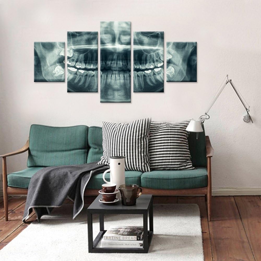 iHAPPYWALL Modern Home Canvas Art X-Ray Dental Tooth Oral Panoramic Peel and Stick Wall Decals The Picture Teeth Decay Print On Canvas For Dental Clinic Wall Decoration