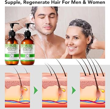 Rosemary Shampoo and Conditioner Set, Hair Growth Rosemary Shampoo and Conditioner Against Hair Loss, Nourishes Scalp, Biotin rosemary oil Hair Thickening Products for Women and Men, Sulfate Free