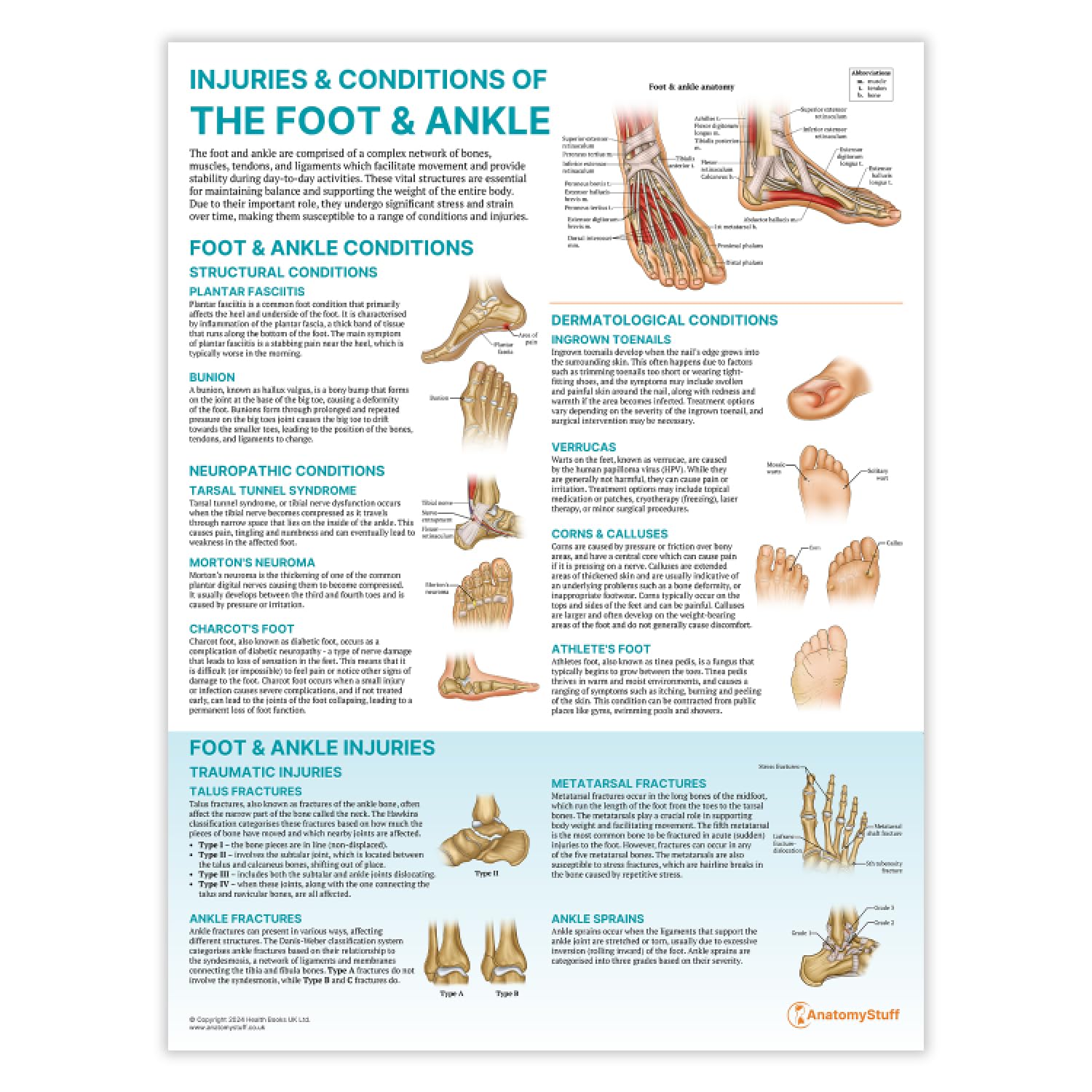 Anatomy Stuff Foot + Ankle Injuries And Conditions Of The Foot And Ankle Poster, 45X60 Cm, 18X24 Inches, Physio Diagram, Sports Medicine Wall Chart