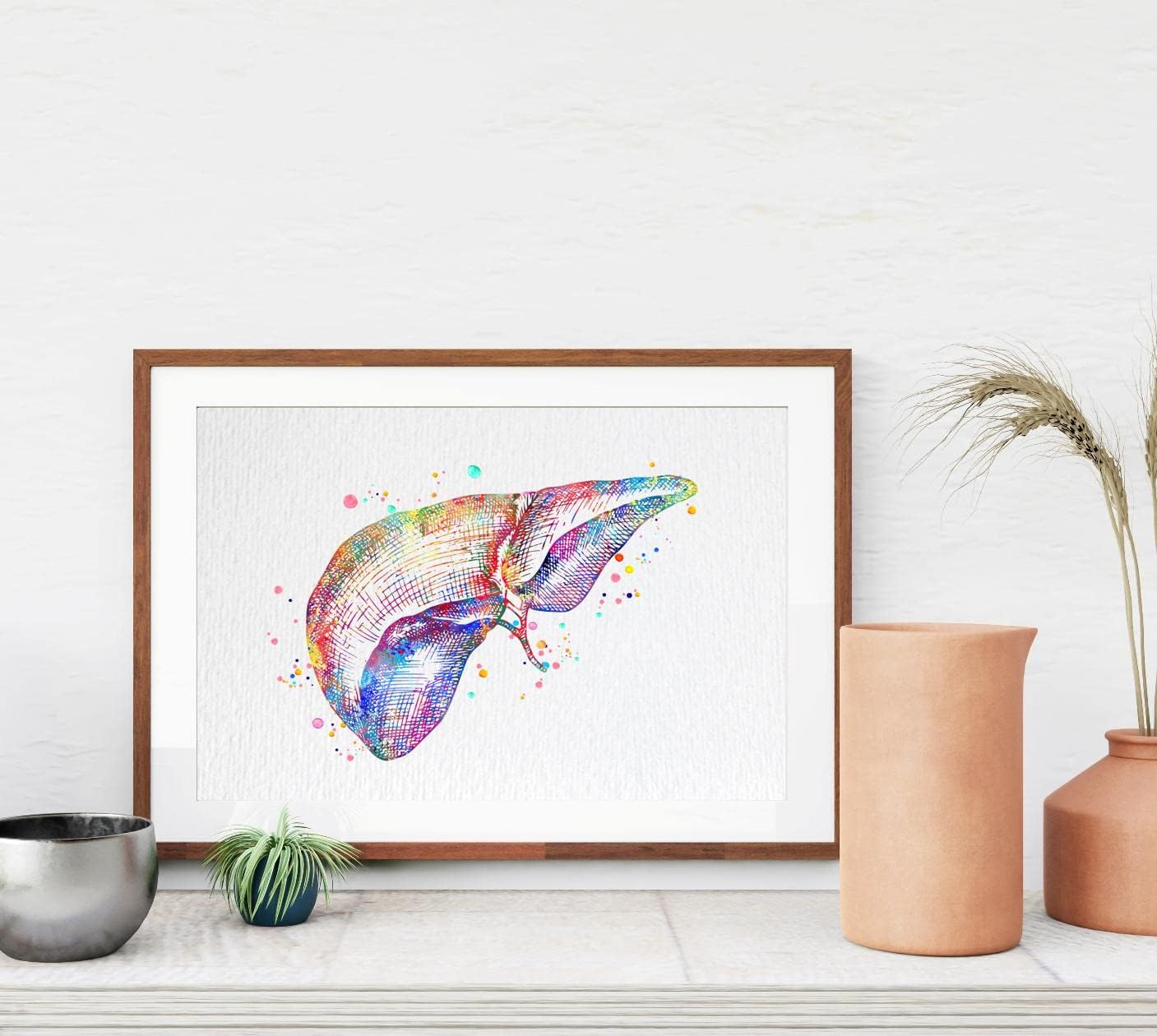 Dignovel Studios 24X30 Unframed Liver Anatomy Human Organs Gastroenterology Clinic Liver Medical Science Watercolor Art Print Poster Wall Hanging Decor DN785