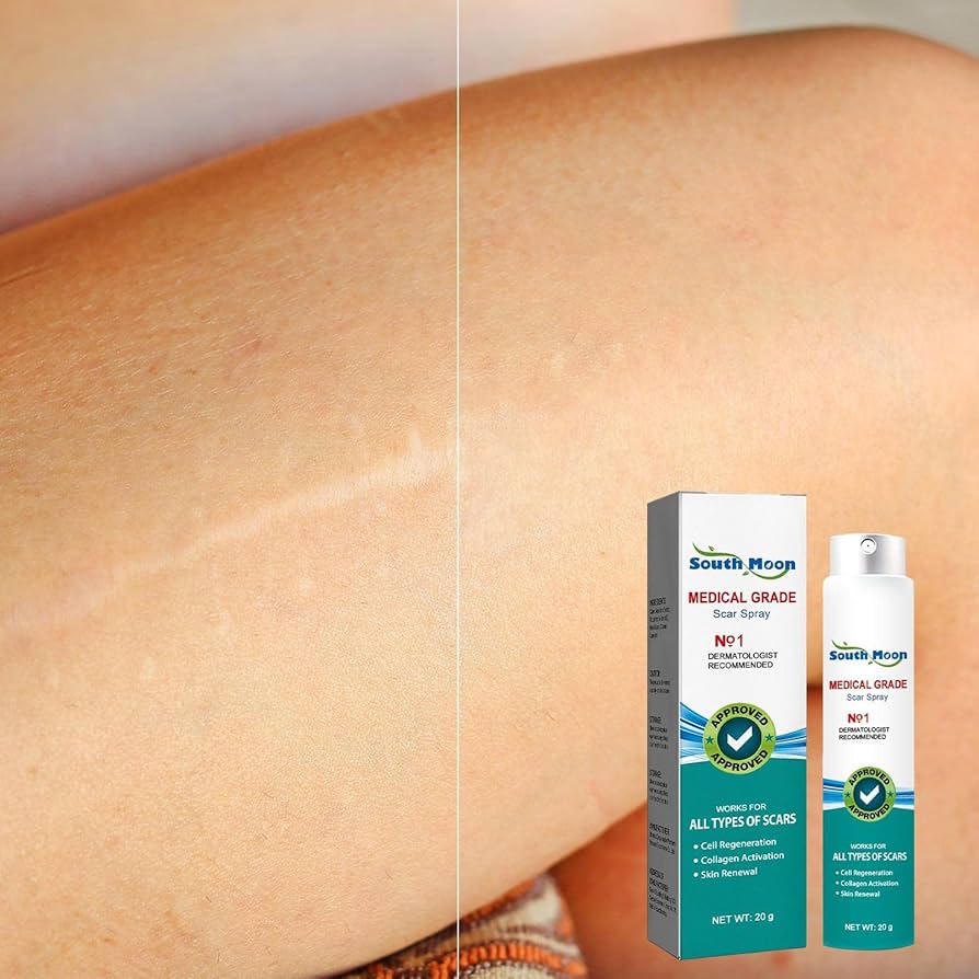 Spray para eliminar cicatrices | Scar Remove Advanced Scar Spray | cicatrices acné para rostro, estrías, queloides | Crema para cicatrices para el cicatrices : Amazon.es: Belleza